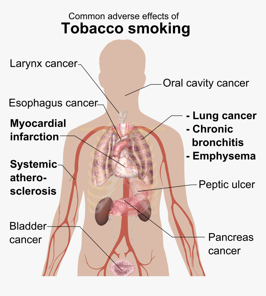 Adverse Effects Of Tobacco Smoking - Disease From Cigarette Smoking, HD Png Download