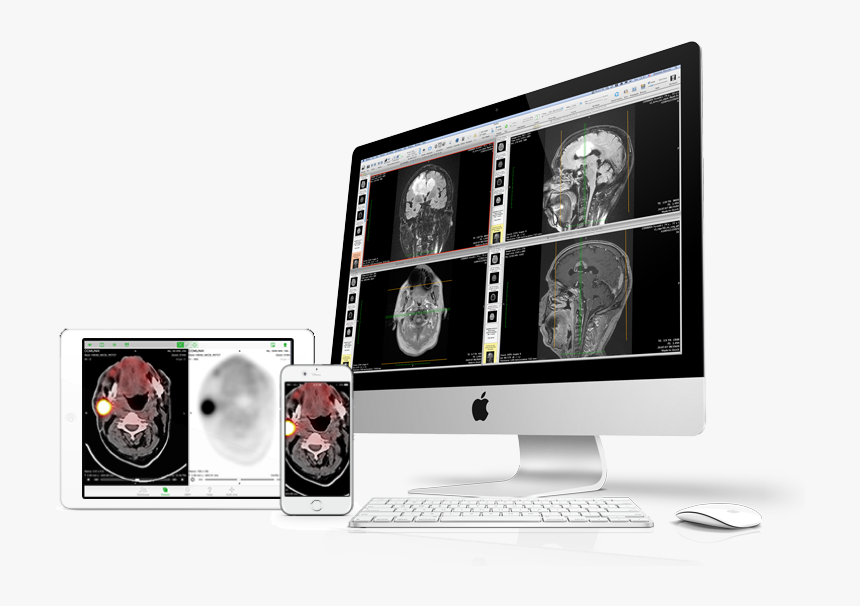 Devices-osirix - Led-backlit Lcd Display, HD Png Download