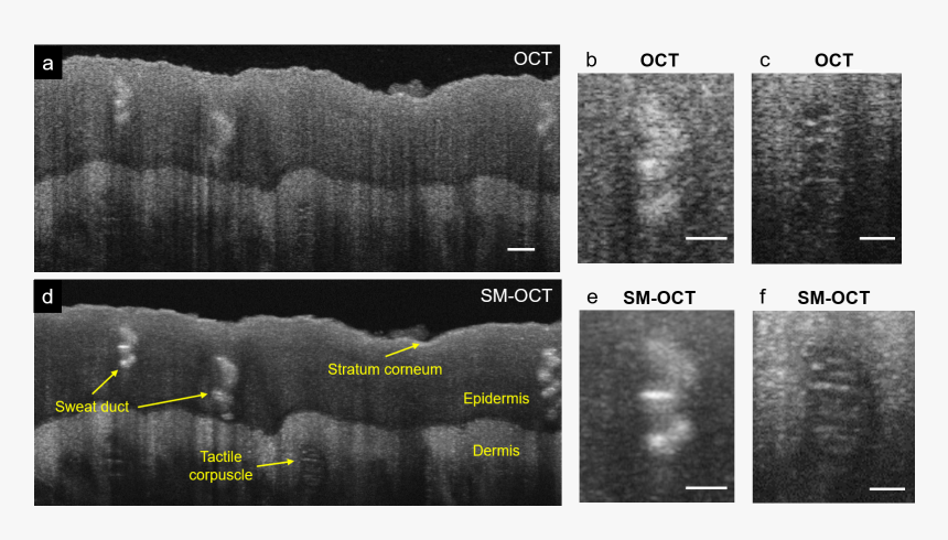 As Part Of Our Efforts To Create A Platform For Molecular - Speckle Modulation Optical Coherence Tomography, HD Png Download