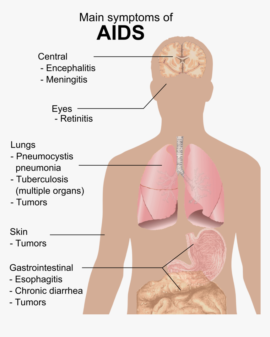 Symptoms Of Aids - Aids Symptoms Png, Transparent Png