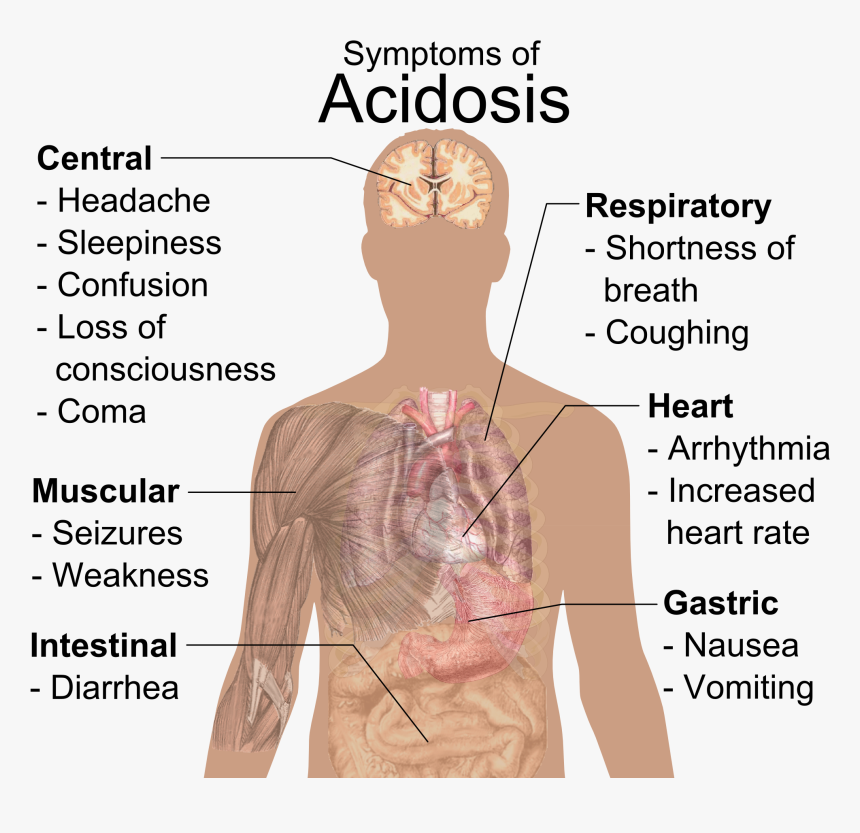 Symptoms Of Acidosis, HD Png Download