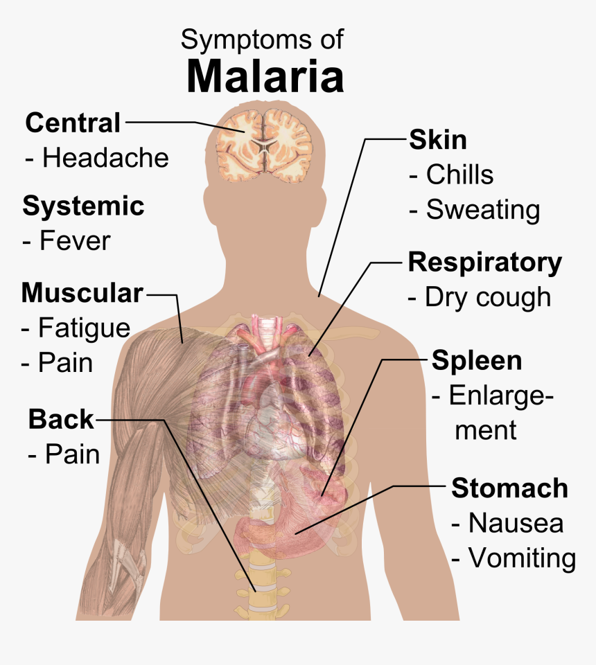Symptoms Of Malaria - Symptom Of Malaria, HD Png Download