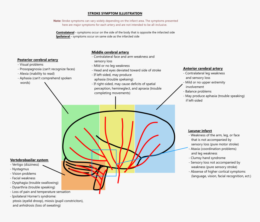 Stroke Artery Symptoms, HD Png Download