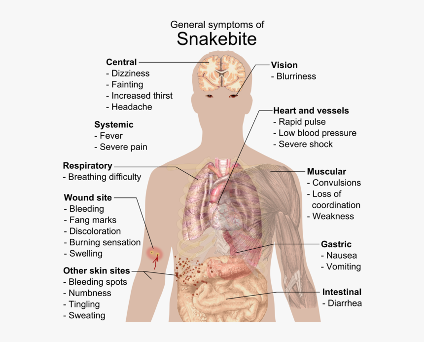 General Symptoms Of Snakebite, HD Png Download