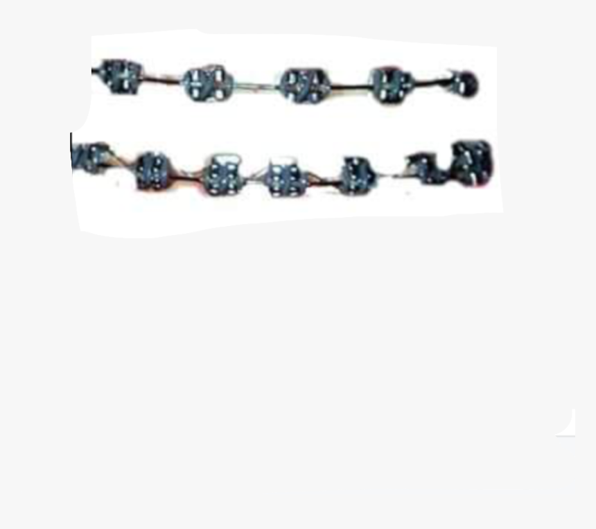 Png Tumblr Pngtumblr Pngs Brackets Smile Freetoedit - Brackets Png, Transparent Png