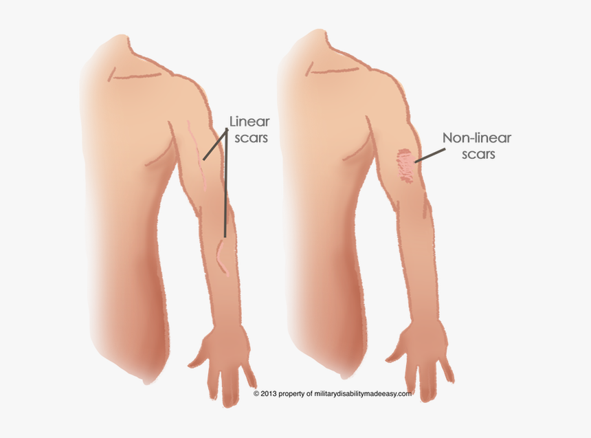 Linear Scars, HD Png Download