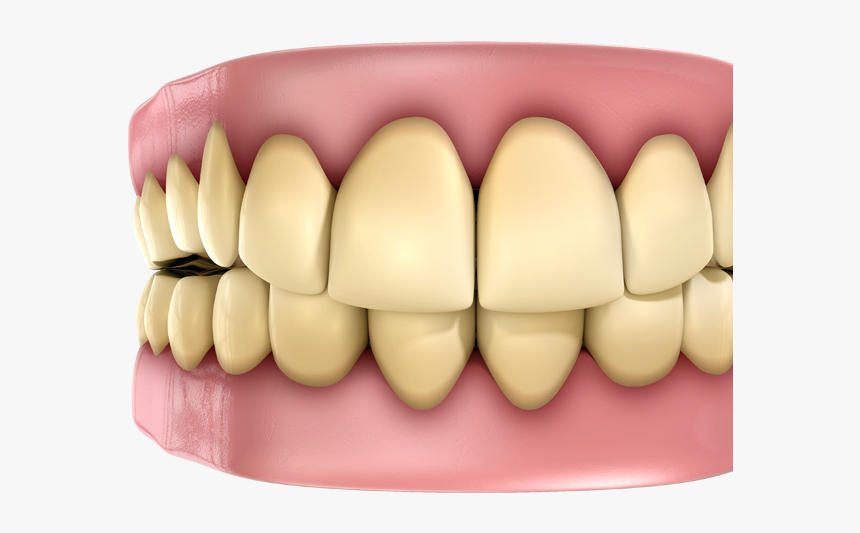 Yellow Teeth Fact And Myth About Health, HD Png Download