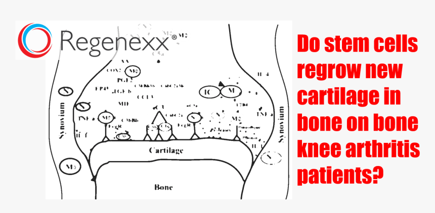 Stem Cells For Bone On Bone - Colegio San Jose Moreno Nieto, HD Png Download