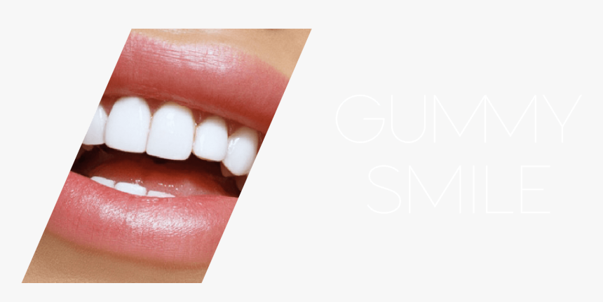 Transparent Smiling Teeth Png - Tongue, Png Download