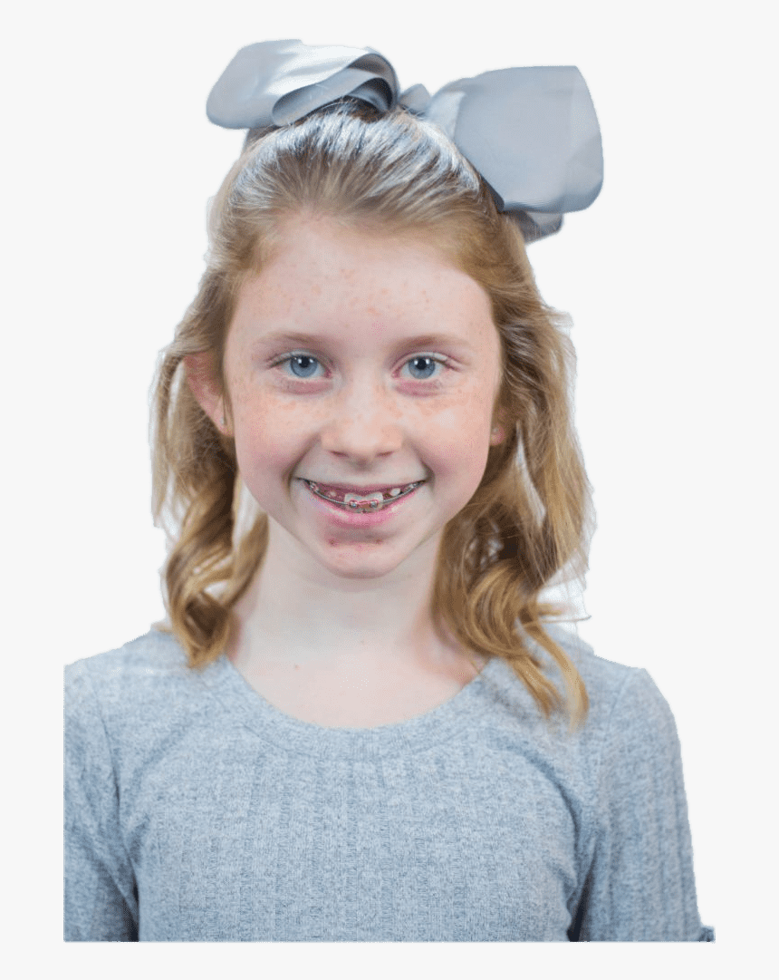 Child Lawless Orthodontics Patient - Child, HD Png Download