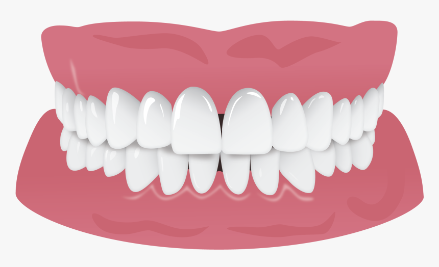 Invisalign Gap Teeth Missing Tooth, HD Png Download