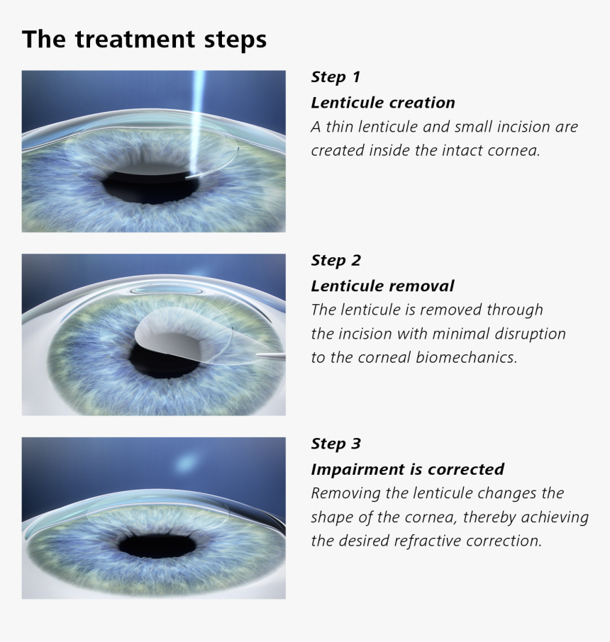 Smile Eye Surgery, HD Png Download