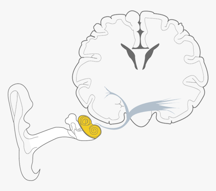 Sensorineural Hearing Loss , Transparent Cartoons - Sensorineural Hearing Loss, HD Png Download