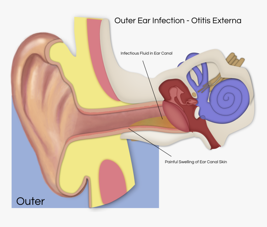 Otitis Media Ear Diagram, HD Png Download