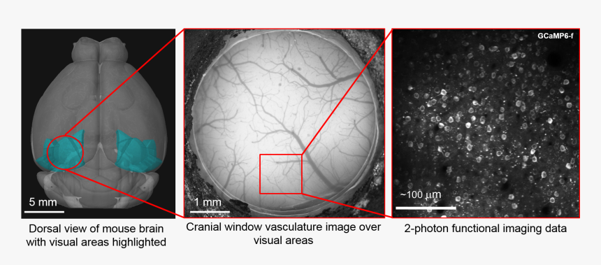Png File Surgery - Visual Cortex Mouse Brain Cranial, Transparent Png
