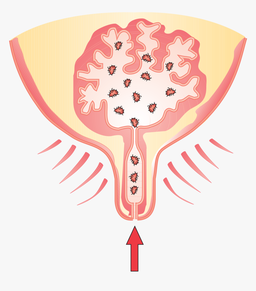 Transparent Soil Clipart - Mastitis In Cow Cartoon, HD Png Download