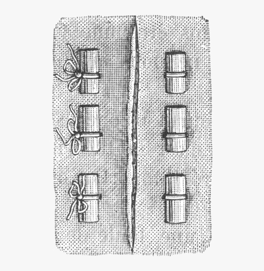 Types Of Stitches Used In Sutures, From Dictionnaire - Types Of Stitches, HD Png Download