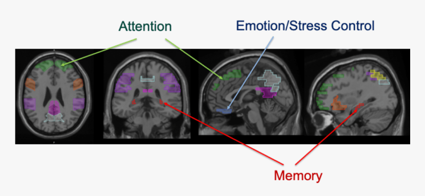 Medical Imaging, HD Png Download