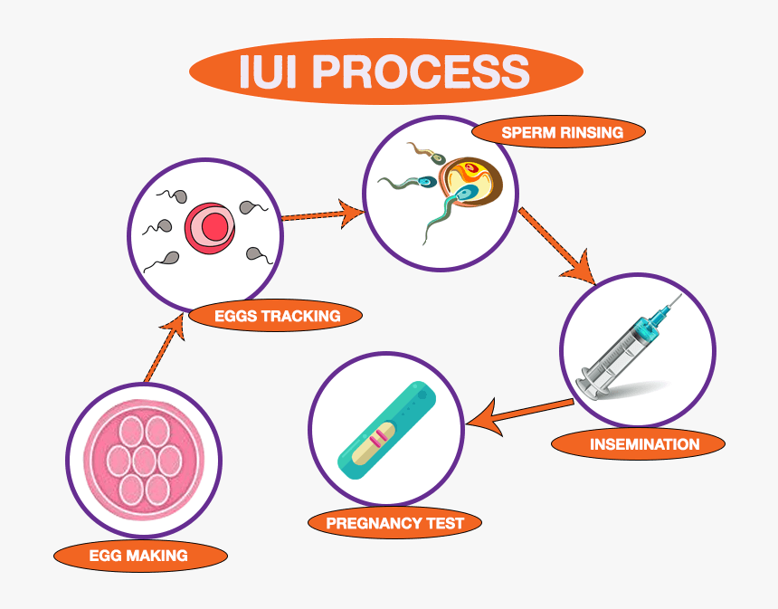 Com/wp Process Png - Iui Treatment Step Step, Transparent Png