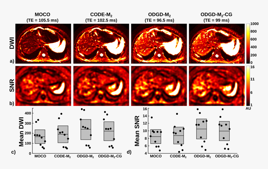 Waveform Png, Transparent Png