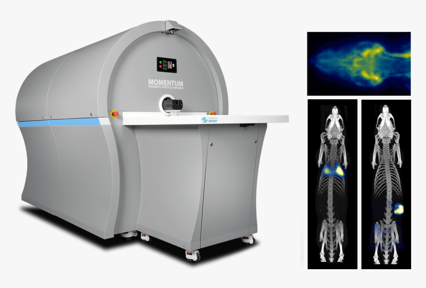 Neurovascular Perfusion And Blood Pool Imaging, HD Png Download