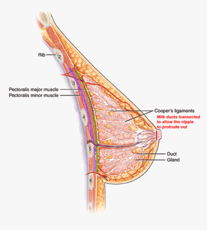 Inverted Nipple Correction Jacksonville Fl - Inverted Nipple Milk Ducts, HD Png Download