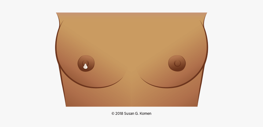 Change In Breast Size, HD Png Download