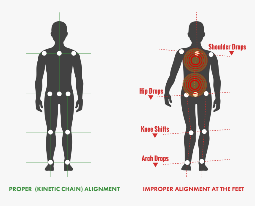 Transparent Back Pain Png - Illustration, Png Download