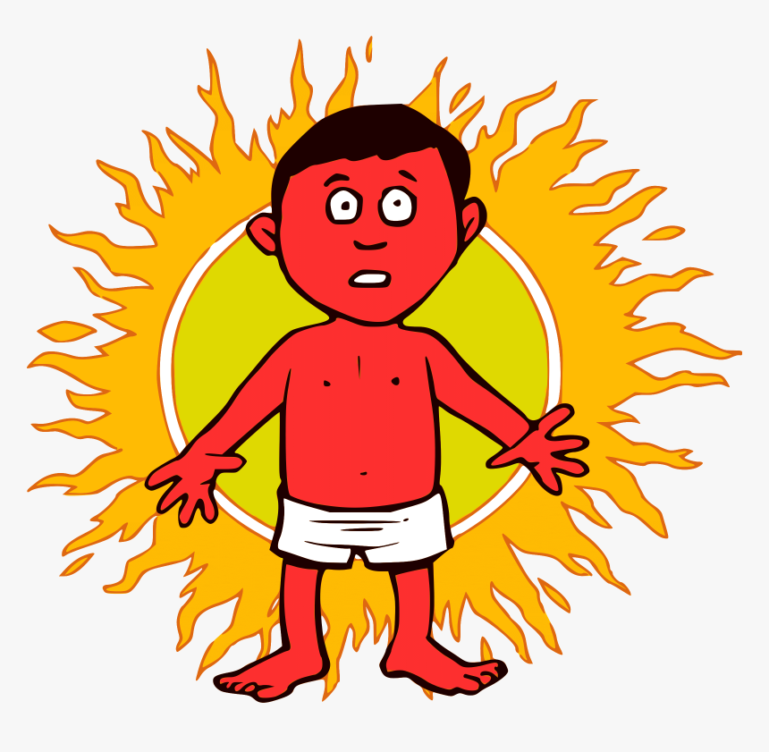 Burnt Cliparts - Sunburn Clipart, HD Png Download