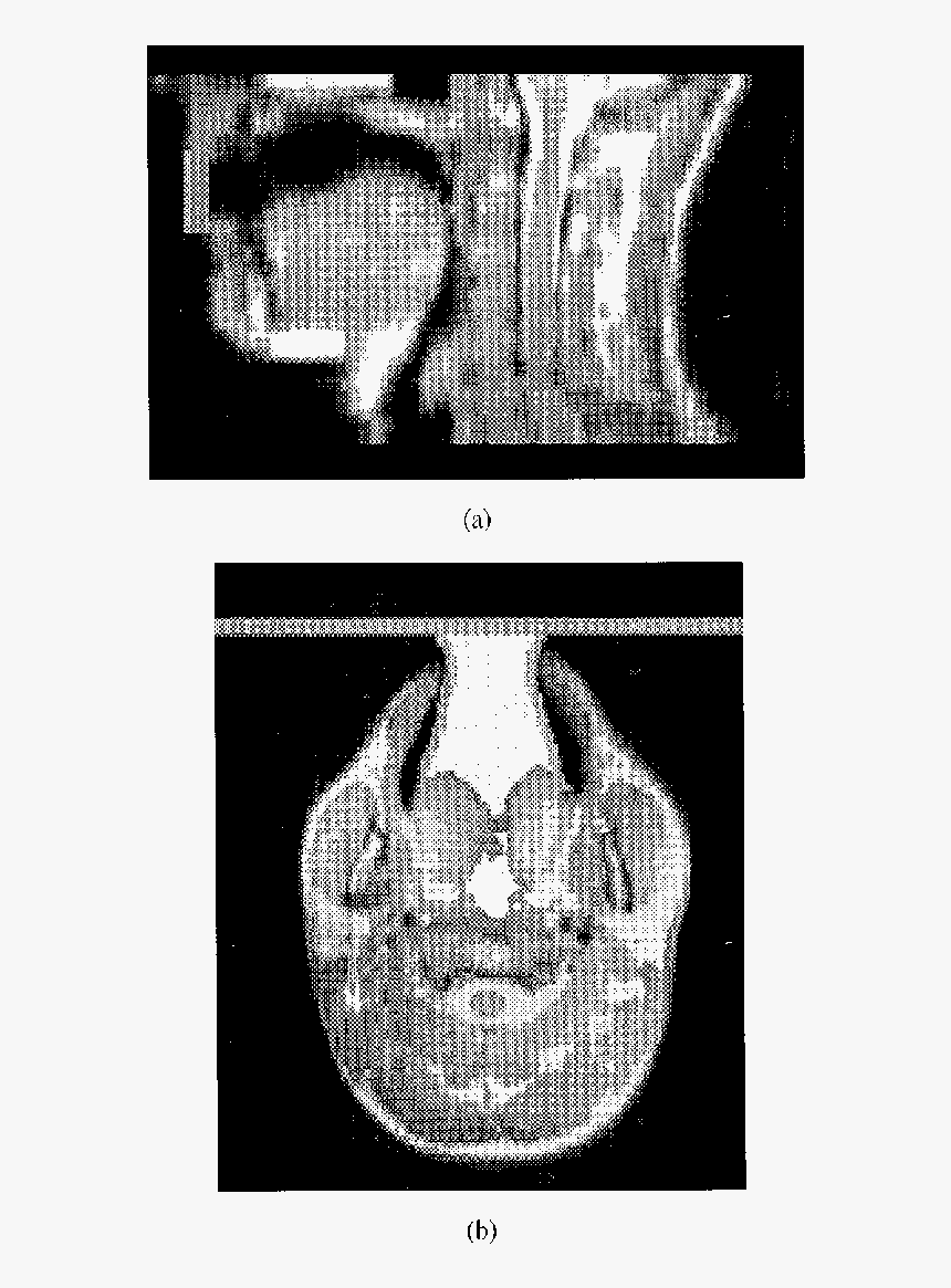 Method Of Terminating The Open Mouth To Contain The - Radiology, HD Png Download