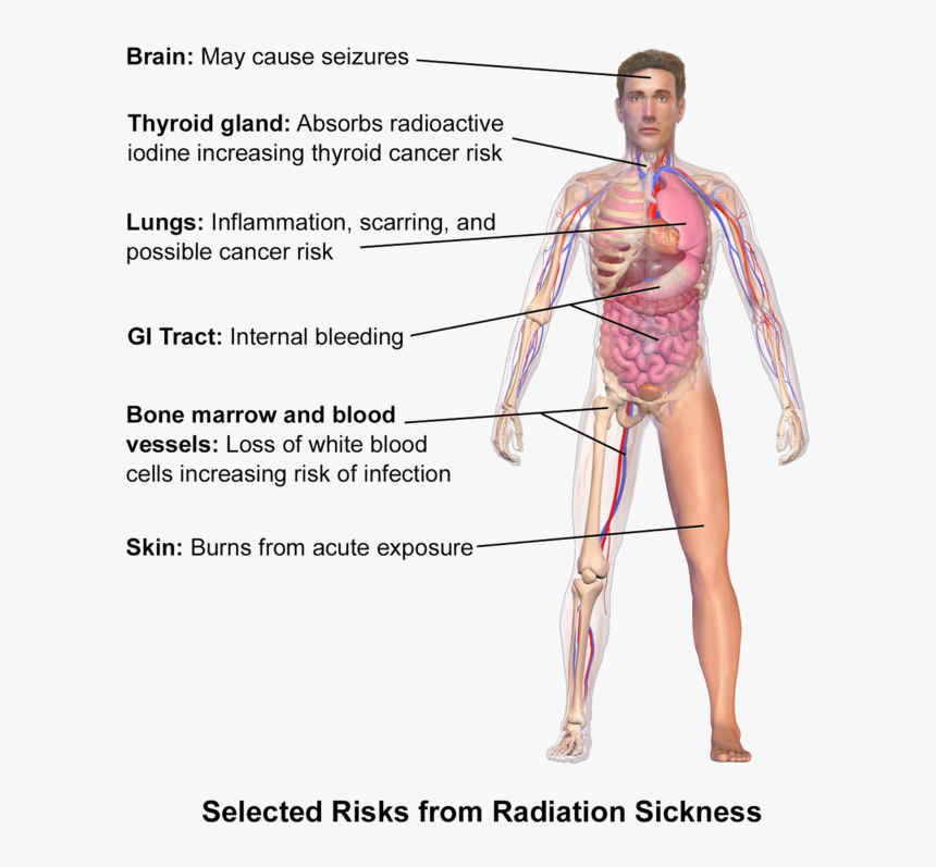 Radiation Poisoning Symptoms, HD Png Download