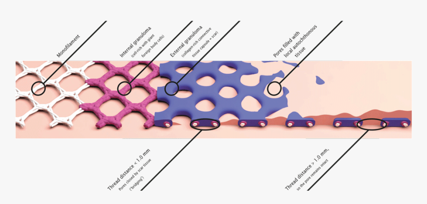 Porositaet Visceral Grafik En - Porosidad De La Malla, HD Png Download
