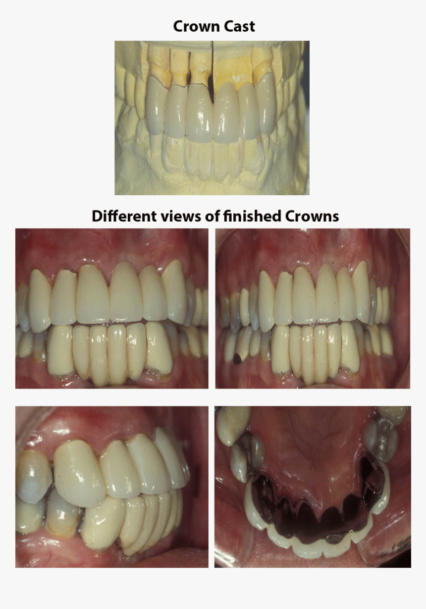 Smile, HD Png Download