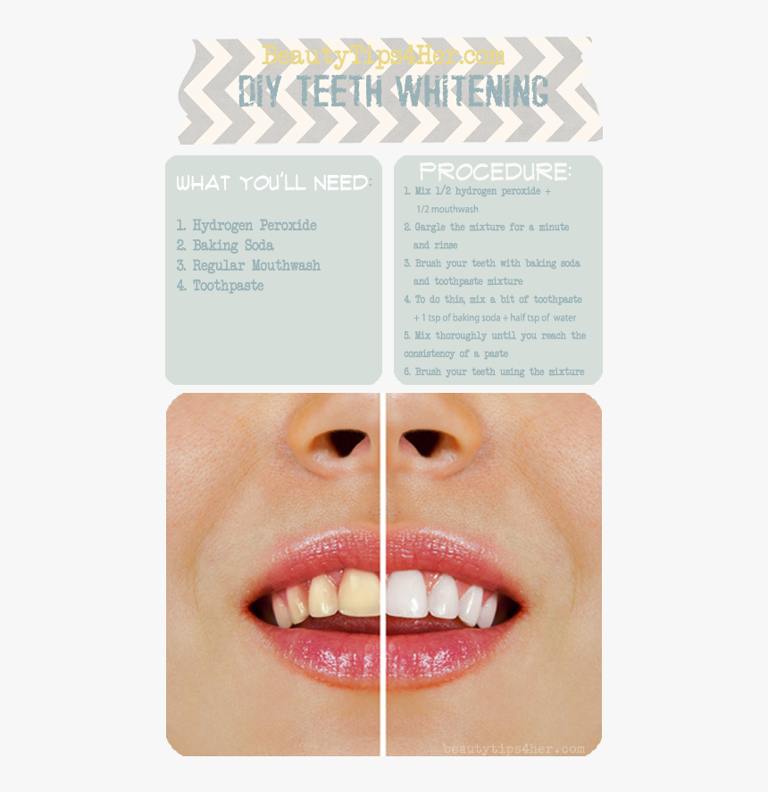 Ways To Make Ur Teeth Straight, HD Png Download