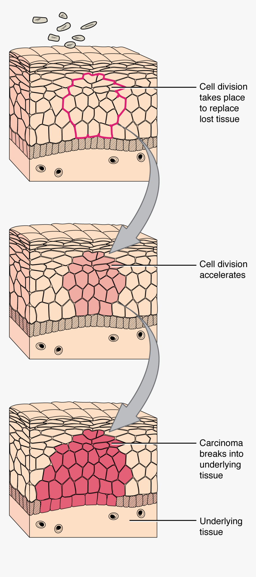 418 Development Of Cancer - Tissue And A Cell Diagram, HD Png Download