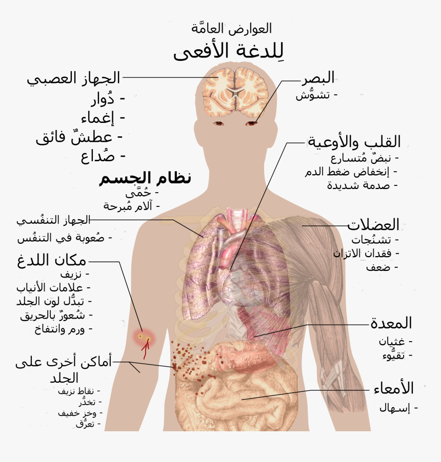 Snake Bite Symptoms-ar - Snake Bite Symptoms, HD Png Download