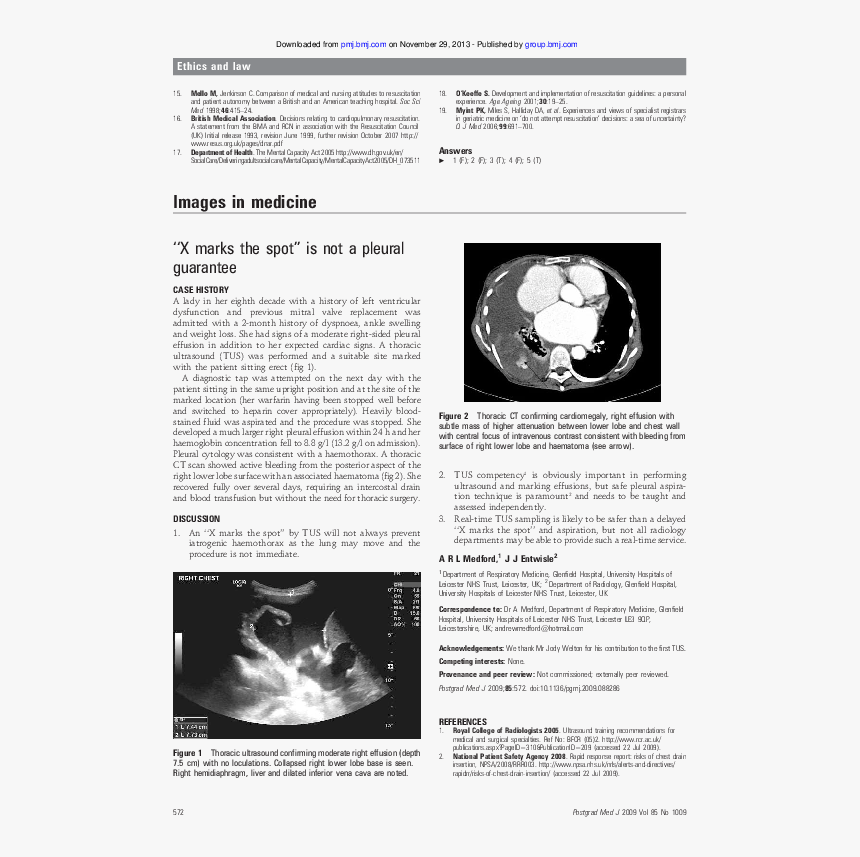 Monochrome, HD Png Download