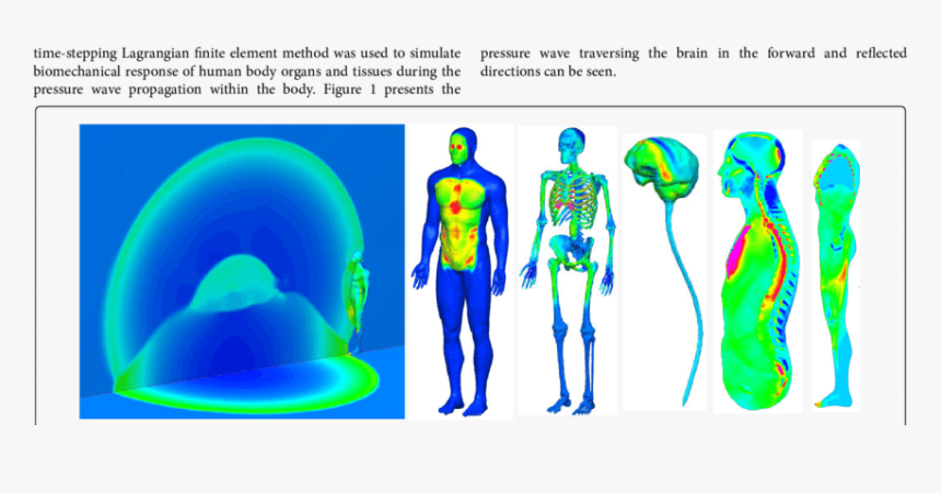 C4 Bomb Blast, HD Png Download