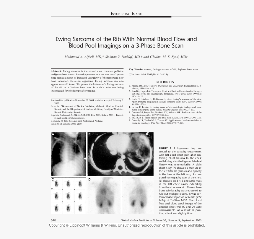 Monochrome, HD Png Download