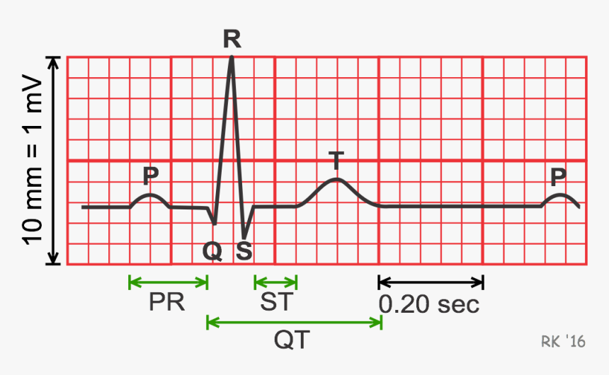 Electrocardiogram Durations And Intervals - Ecg Duration, HD Png Download