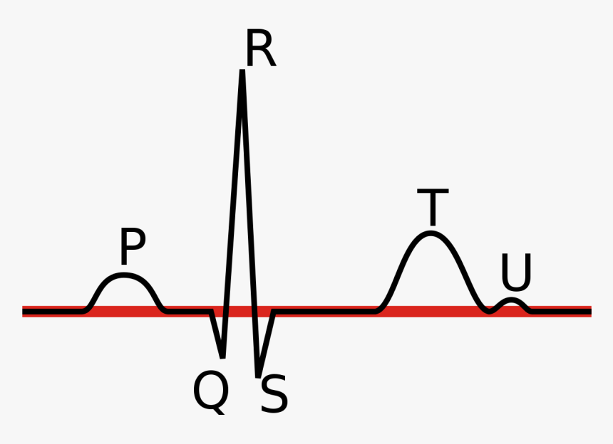 Linia Izoelektryczna Ekg - Popis Ekg, HD Png Download
