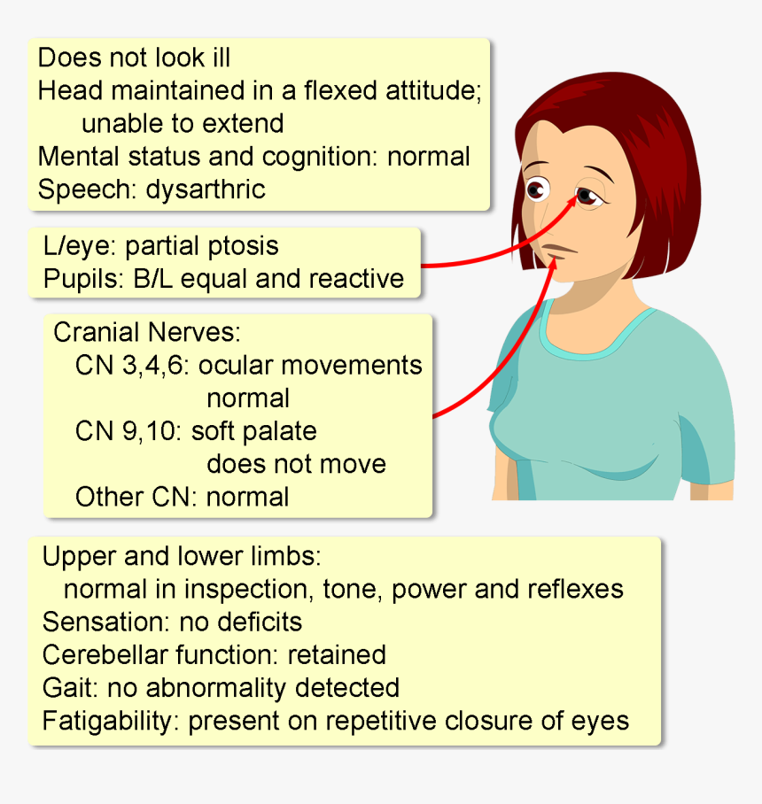 Ocular Myasthenia Gravis History, HD Png Download