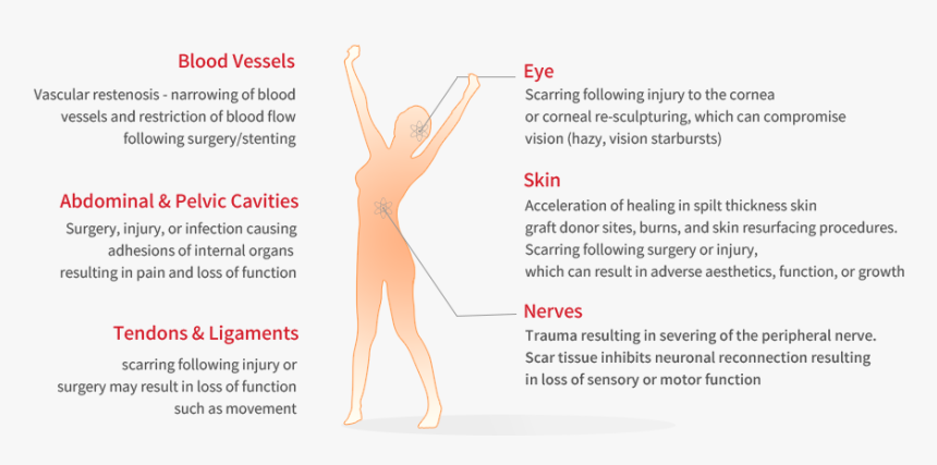 Other Applications Of Olx101 - Tan, HD Png Download