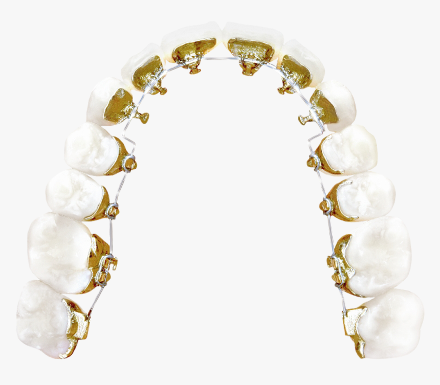 Lingual Braces - Pearl, HD Png Download
