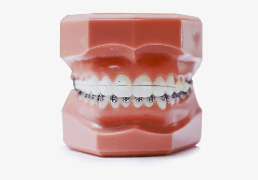 Straight Teeth Model, HD Png Download