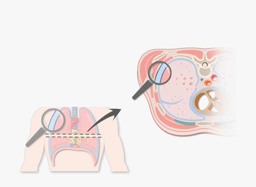 An Expanded View Of The Thorax Magnifying The Pleura - Two Transparent Pleural Membranes, HD Png Download