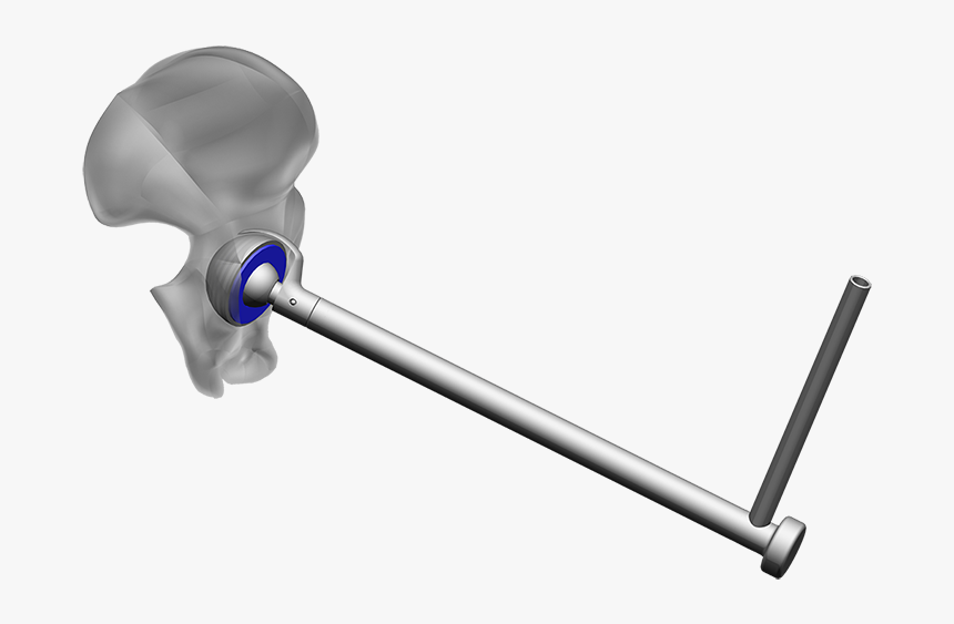 Erweitert1 - Endocon - Produkte - Hueftpfannenschneider, HD Png Download