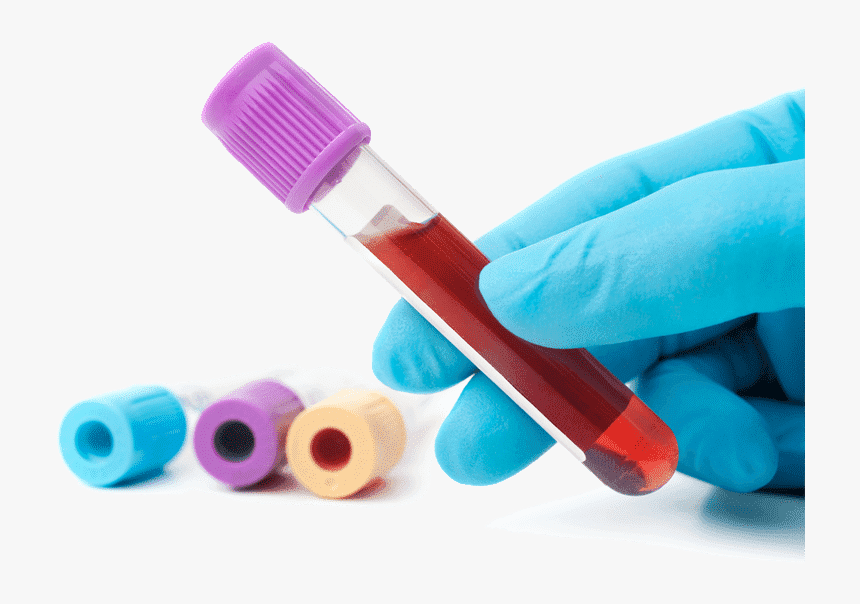 Transparent Sangre Png - Prise De Sang Lactose, Png Download