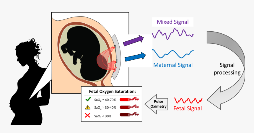 Pregnant Silhouette Clip Art, HD Png Download