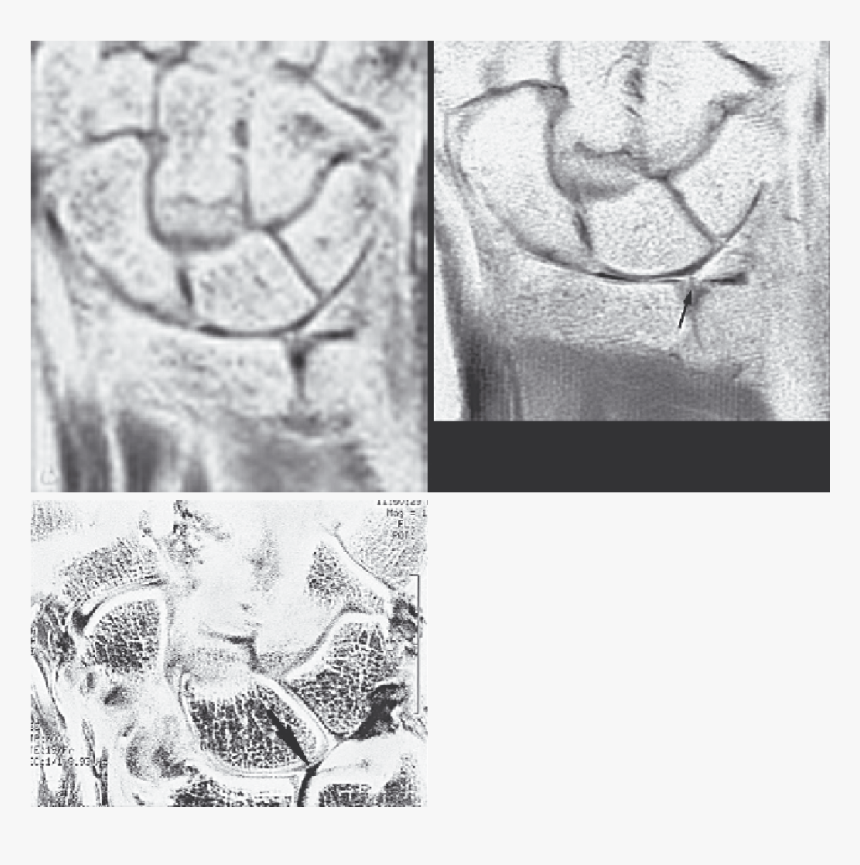 Sketch, HD Png Download